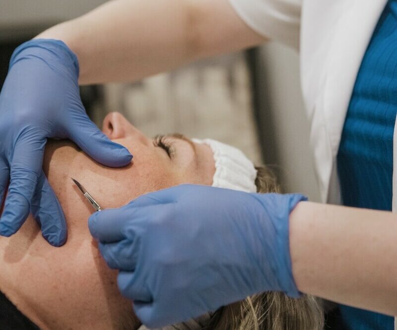 Men's skin, Men's skincare, men's hair loss, hair loss, men's facial, metrosexual, men's acne, nose wax, ear wax, mens waxing, Charlotte, NC, SouthPark, Esthetician, Esthetics, Skincare, Facials, Treatments, Skin, Skin help, Anti-aging, Age management, wrinkle help, wrinkle treatment, Acne, Teen acne, Adult acne, clogged pores, Med-spa, Custom facial, Microneedling, Microchanneling, Waxing, Facial waxing, Corrective Skincare, Dermaplaning, Dermaplane, Plasma Fibroblast, Chemical peels, Face peels, LED therapy, LED facials, Skin resurfacing, Opti resurfacing, Beauty, Facial beauty, Facial hair, Botox, Fillers, Rosacea, Skin extractions, Oily skin help, Blackhead help, Woodlawn, Park Road, Park Rd, Park Road Shopping Center, Tyvola, I-485, South Charlotte, Eastover, Cotswold, Ballantyne, Dilworth, Southend, LoSo, Selwyn, Freedom Park, I-77, SouthPark mall, Salt room, Salt therapy, Reliable, Honest, Affordable, Quality, Responsible, Licensed, Certified, Dermatology, Dermatologist, Archdale, Noda, Uptown, Quail Hollow, Seven Eagles, Piedmont Row, Queen City, Carmel, Cysts, Cystic Acne, Pimple Popper, Pineville, South Blvd, Quail Corners, Recommended, Stonecrest, Steele Creek, Yorkmount, 5 stars, Aging, BBB, Belmont, Best, Best of, Better Business Bureau, Bonded, Business, Plant based, Natural, Caring, Calm, Carolina Mall, Budget, Concord, Huntersville, Five star, Friendly, Trustworthy, Help, Tips, Treatment, Laser, Inexpensive, Fair, Instagram, Joy, Mental Health, OCD, Dermatillomania, Luxury, Myers Park, Teen, Teenager, North Carolina, Over 40, Over 30, Over 50, Piper Glen, Price, Privacy, Pro, Professional, Raintree, Providence Plantation, Metropolitan, Providence Road, Toringdon, Carmel Commons, Trust, Training, Waverly, Weddington, Cosmetology, Waxing, Bikini Wax, Eyebrow Wax, Lip Wax, Face wax, Mask, Maskne, Backne, Cleanser, Toner, Cream, Retinol, Retinoid, Exfoliate, Exfoliater, Exfoliating, Massage, Hair removal, Products, 704, Charlotte Business, Clogged, Comedones, Nodules, Papules, Pustules, Acne Vulgaris, Fungal, Hyperpigmentation, Hypopigmentation, Excess oil, Dead skin, Texture, Brightening, Dark spots, Willmore, Sedgefield, Hormonal,