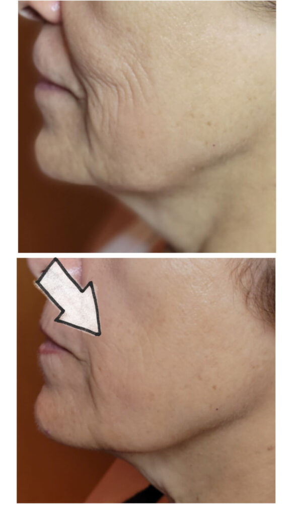 anti-aging treatment Charlotte NC