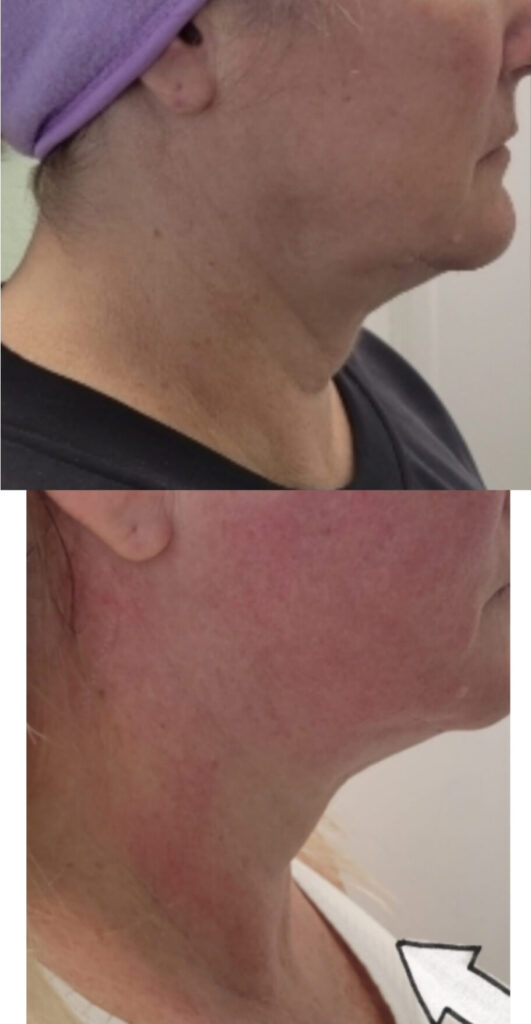 anti-aging Charlotte NC