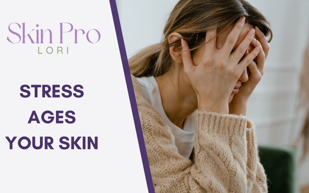 Stress Ages Your Skin: Tips to Prevent Premature Aging in Charlotte, North Carolina